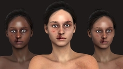 Female Injured Textures